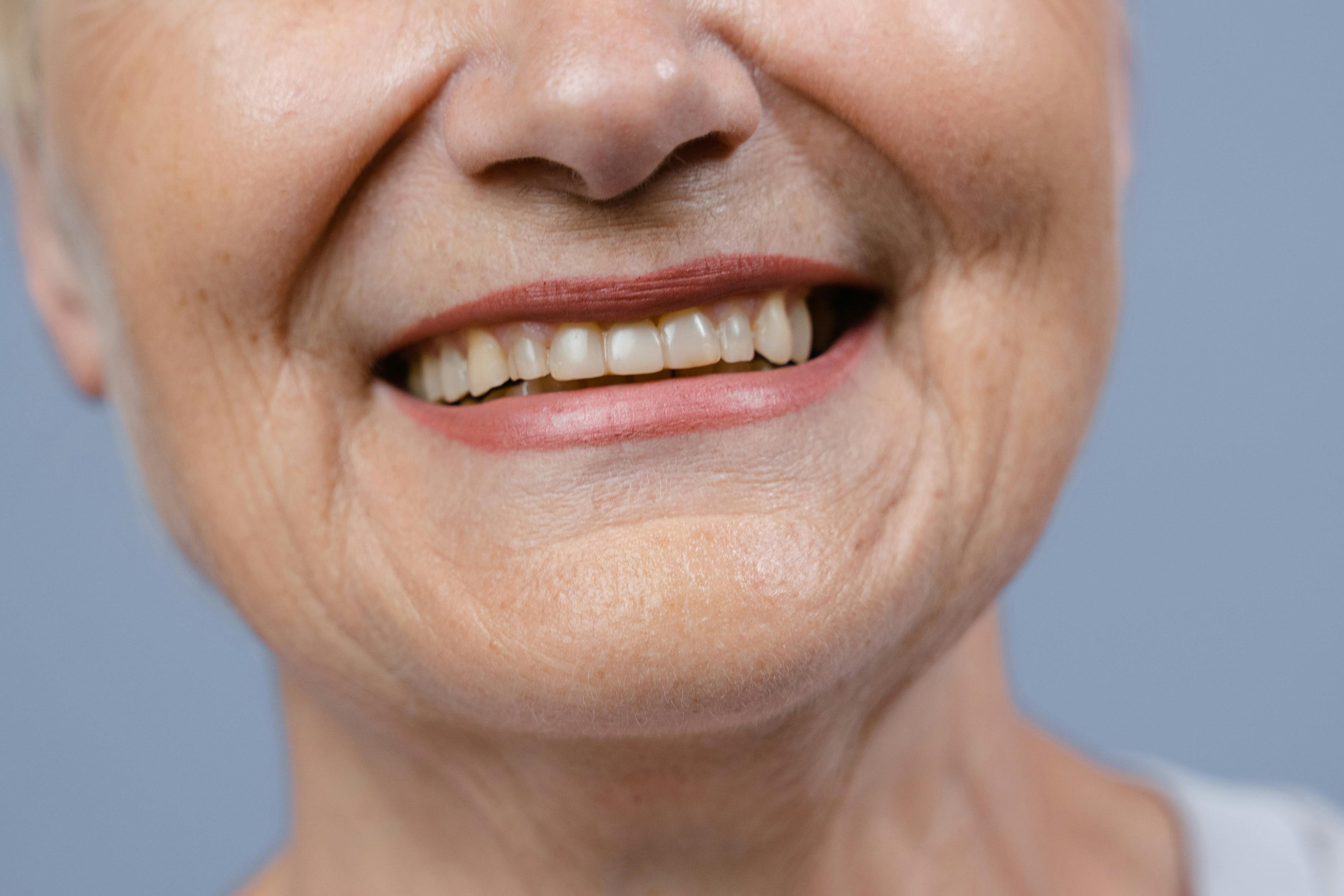 Anti-Aging