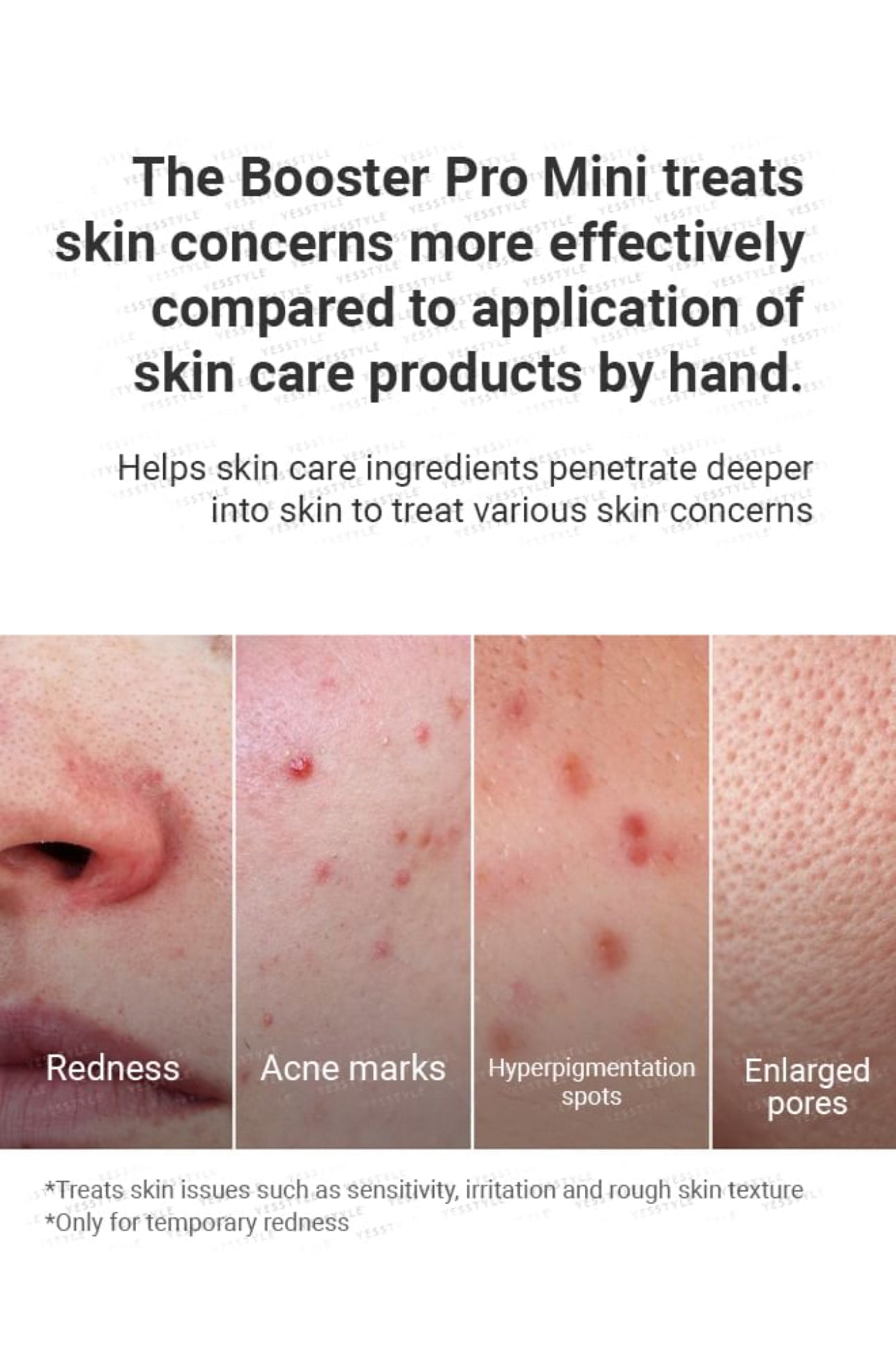 Medicube AGE-R Booster Pro Mini Pink Korean Glow Skin Device for Soothing & Brightening Care Promotes Absorption Medicube
