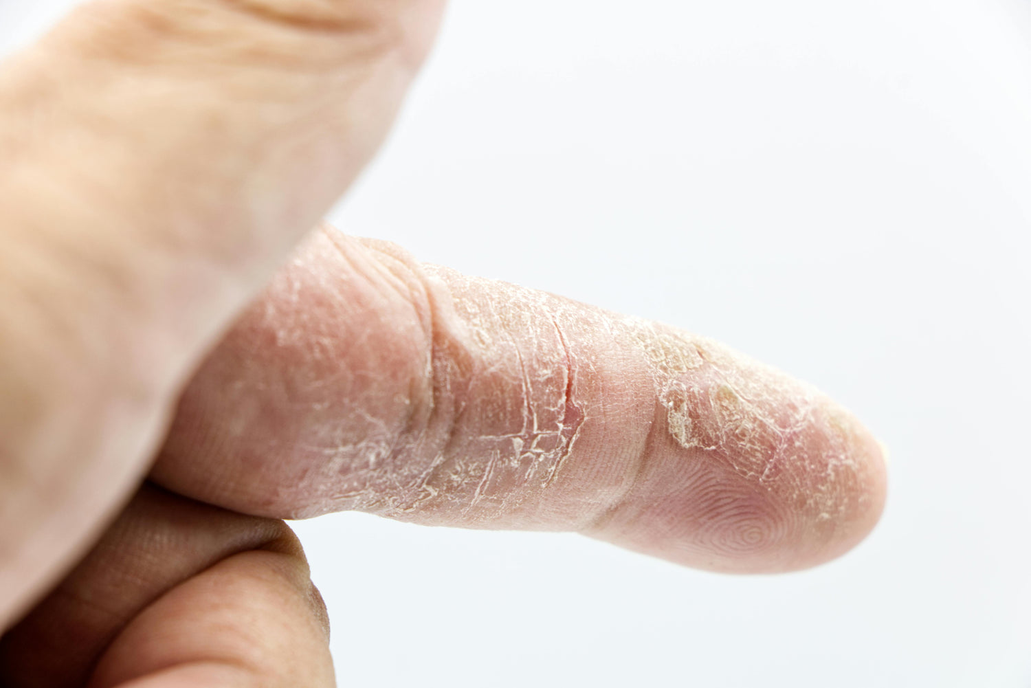 Dull-Uneven-Skin 21stCY