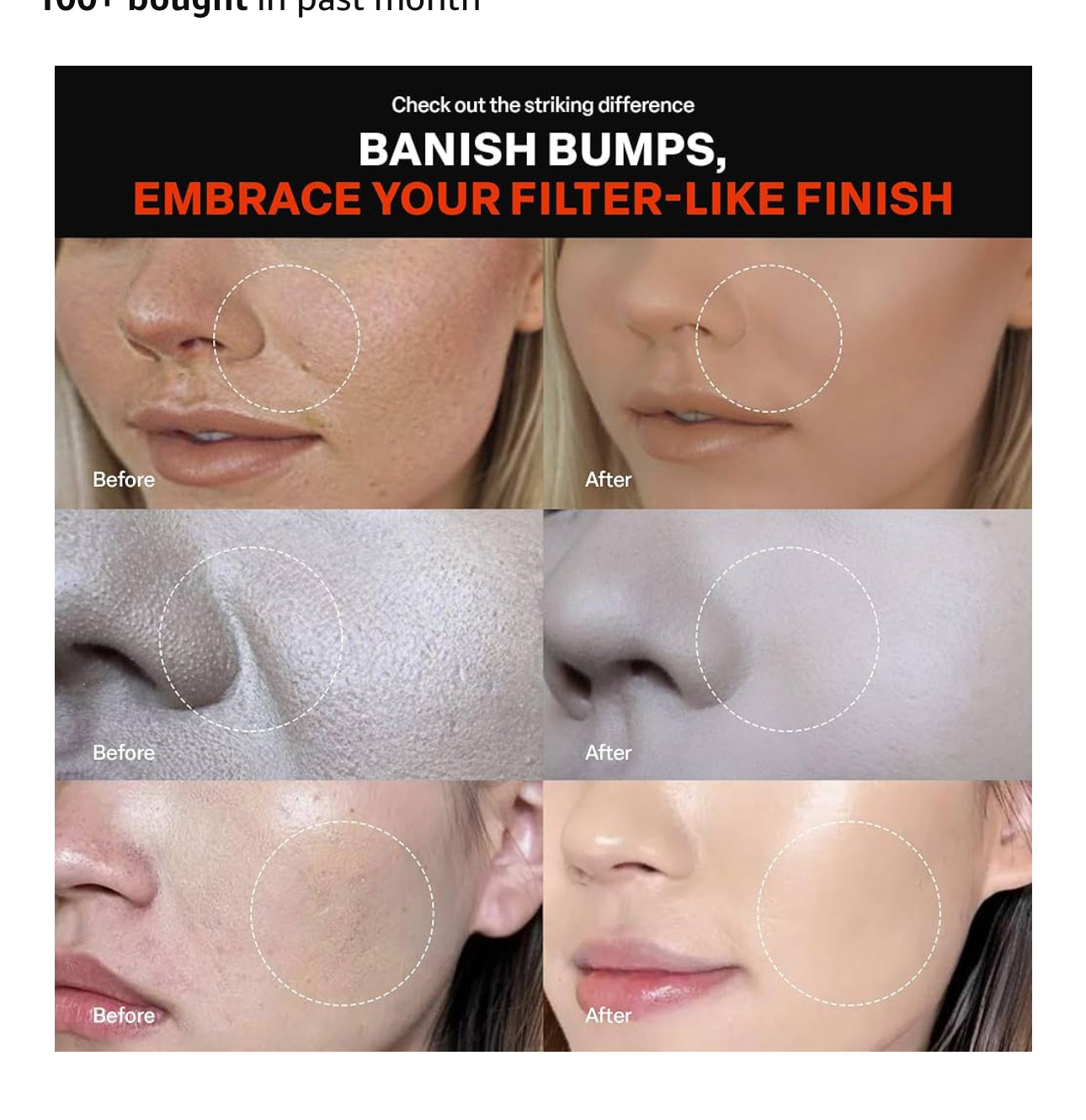 PURCELL 24/7 Colostrum Pore Defence Ampoule with PIXELL BIOM before and after skin improvement results