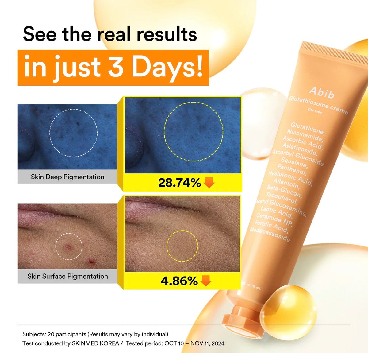 Glutathiosome dark spot cream Vita tube Abib