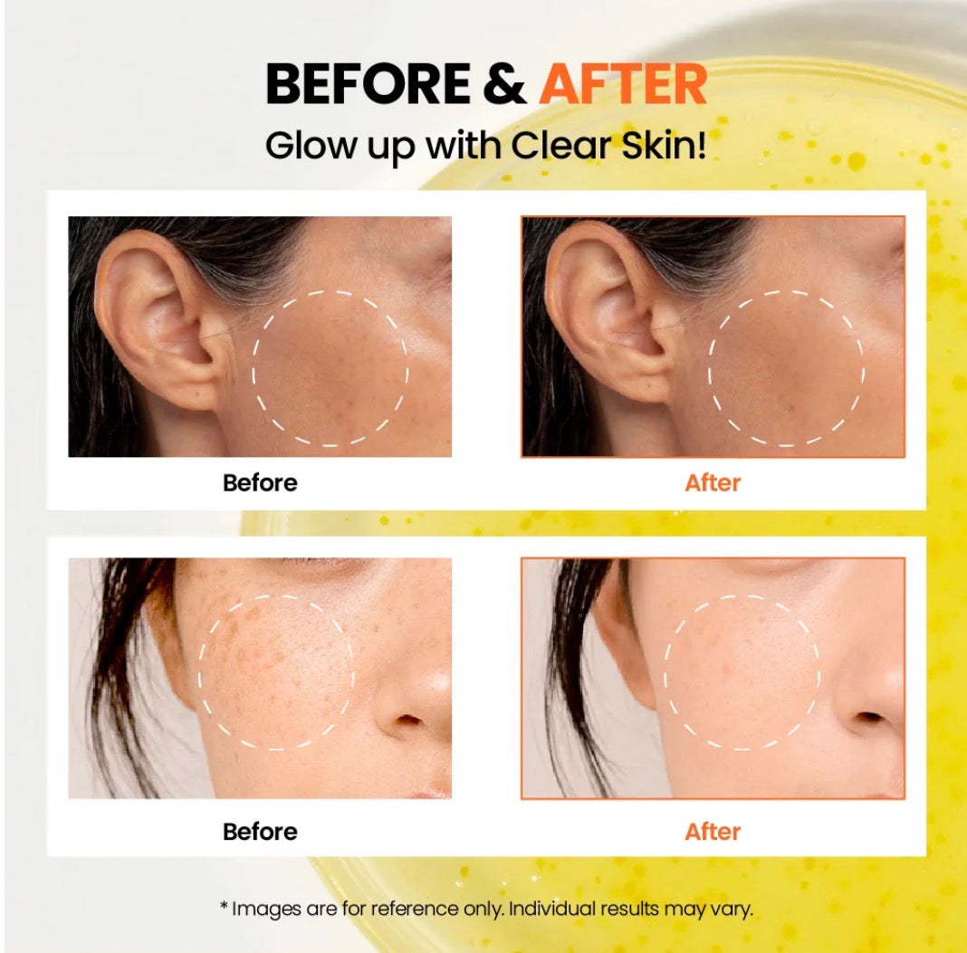 K-Secret SEOUL 1988 GLOW SERUM : NIACINAMIDE 15% + YUJA K Secrect