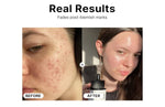 COSRX Niacinamide 15% Face Serum, Minimizing Pores & Sebums, Blemish Treatments for Discoloration, Dark Spots, Enlarged Pores, Anti-aging, 20 ml, Cosrx