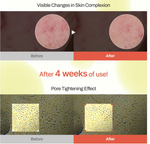 Meditherapy - Retinal Skin Booster Serum Meditherapy