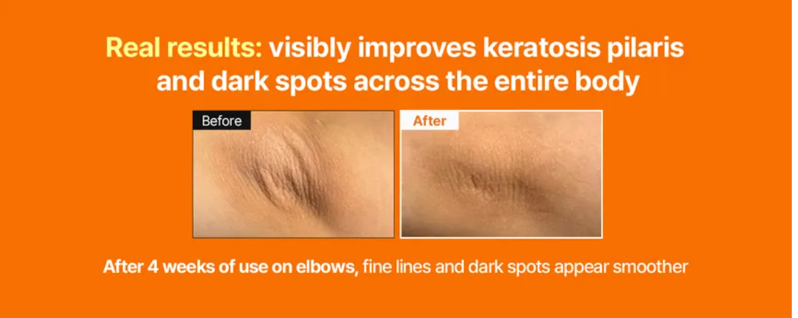 Meditherapy - Retinal Skin Booster Serum Meditherapy